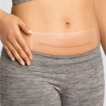 AMOENA | 011-CuraScare Square Silicone Scar Patch