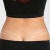 AMOENA | CuraScar Silicone Scar Strips - Image 3